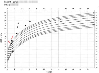 Measuring Maximum Head Circumference Within the Picture Archiving and Communication System: A Fully Automatic Approach